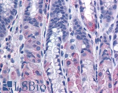 PathPlus™ CCKBR / Cckb Antibody (Extracellular Domain)