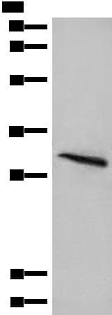 ABRI / ITM2B Antibody