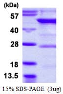 Human YARS2 Protein (Recombinant His)