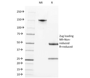 CR2 / CD21 Antibody (clone CR2/1952)