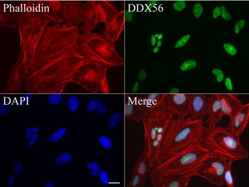 DDX56 Antibody (aa323-547, clone UMAB152)