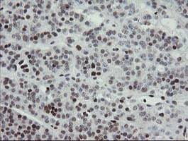 TLE1 / TLE 1 Antibody (clone OTI1D6)