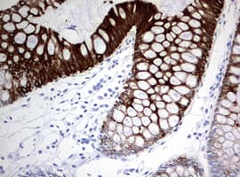 Monoclonal Mouse anti-Human KRT20 / CK20 / Cytokeratin 20 Antibody (clone OTI3G1, IHC, WB)