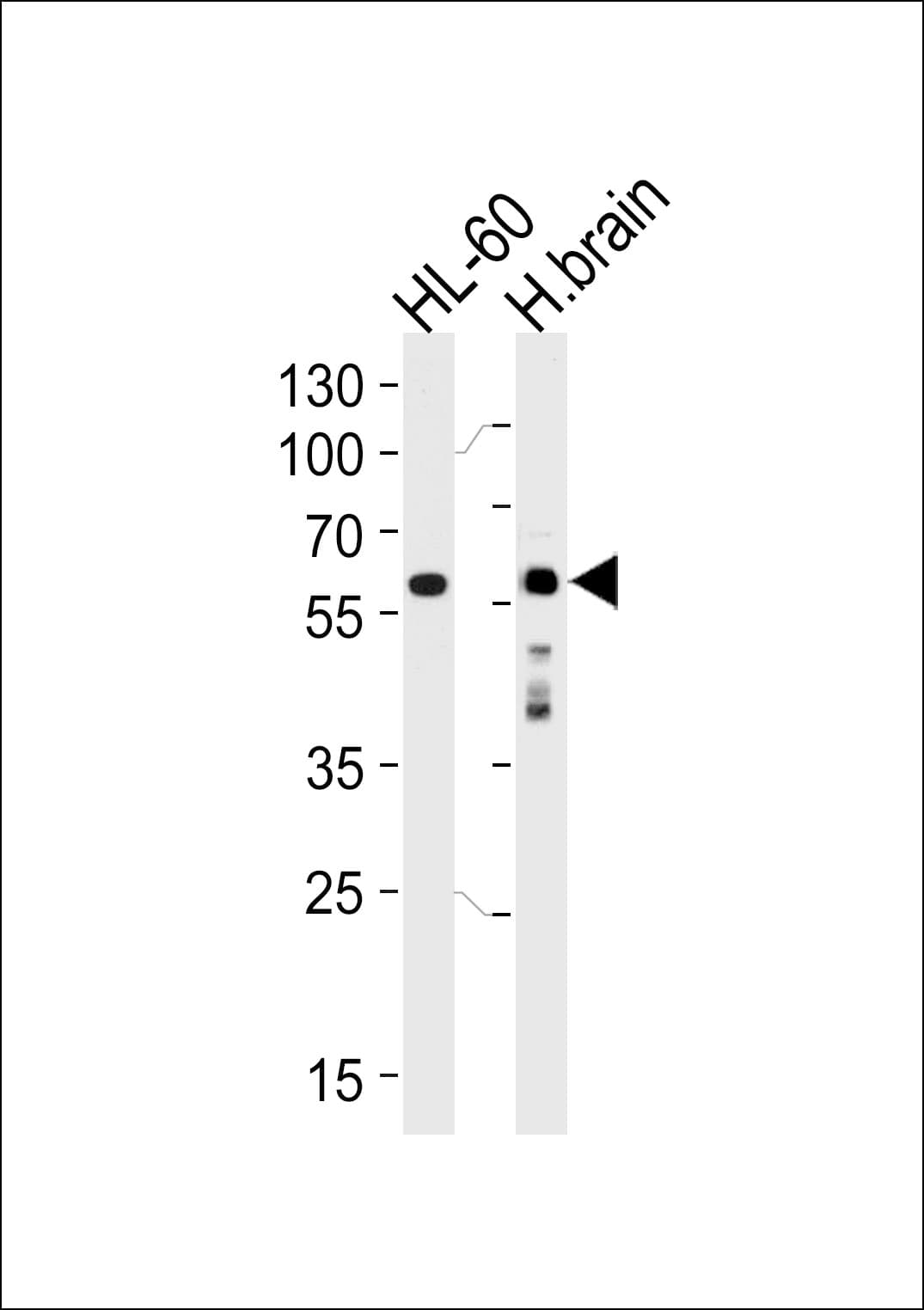 Syndapin I / PACSIN1 Antibody (aa8-38)