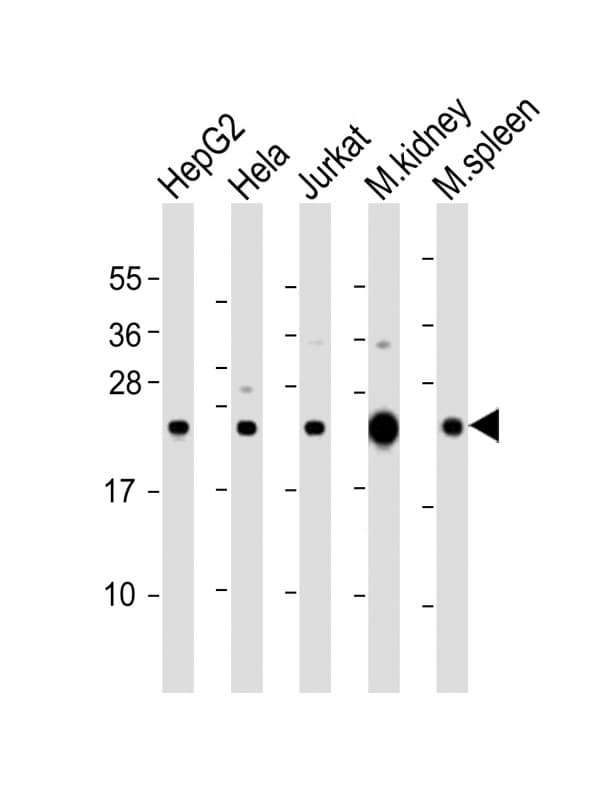 NDUFB9 Antibody (aa97-131)