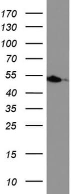 HMBS / PBGD Antibody (clone UMAB144)