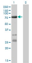ACS5 / ACSL5 Antibody (clone 5H8)