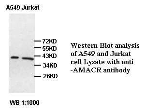 AMACR / P504S Antibody