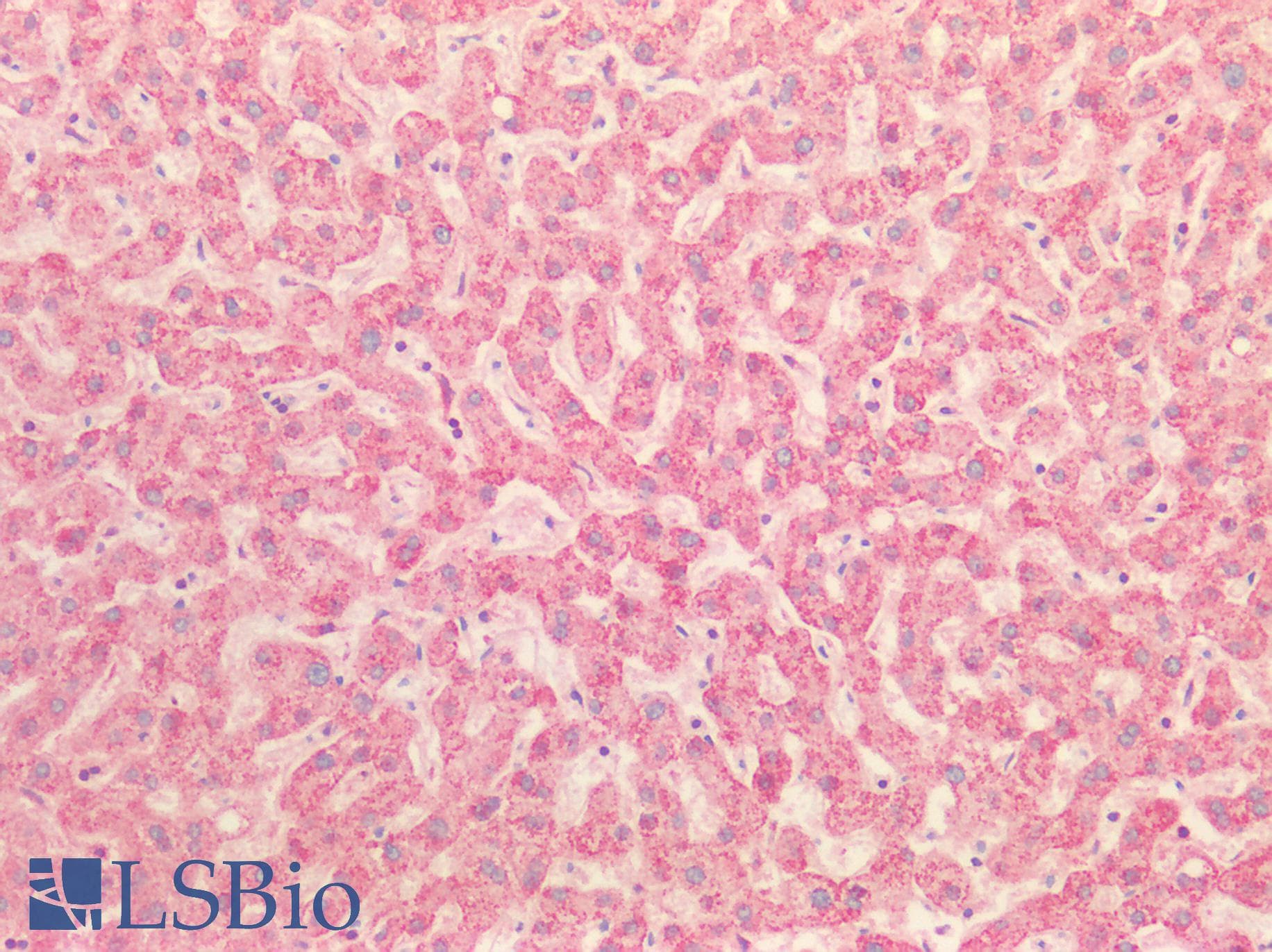 IHC-plus™ Polyclonal Rabbit anti-Human HSP90B1 / GP96 / GRP94 Antibody (aa16-43, IHC, IF, WB)