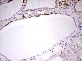 CDCA7L Antibody (aa1-337, clone OTI2C1)