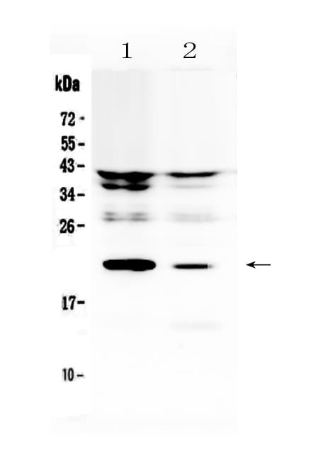 Polyclonal Rabbit anti-Rat IL11 Antibody (WB)