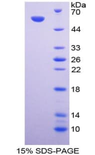 Human CANX / Calnexin Protein (Recombinant His-GST)