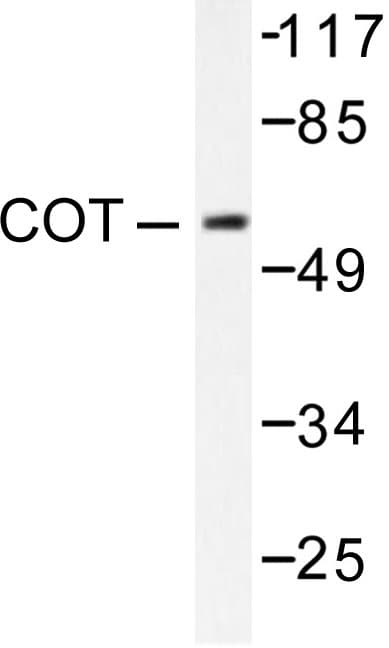 MAP3K8 / TPL2 Antibody (Pro284)
