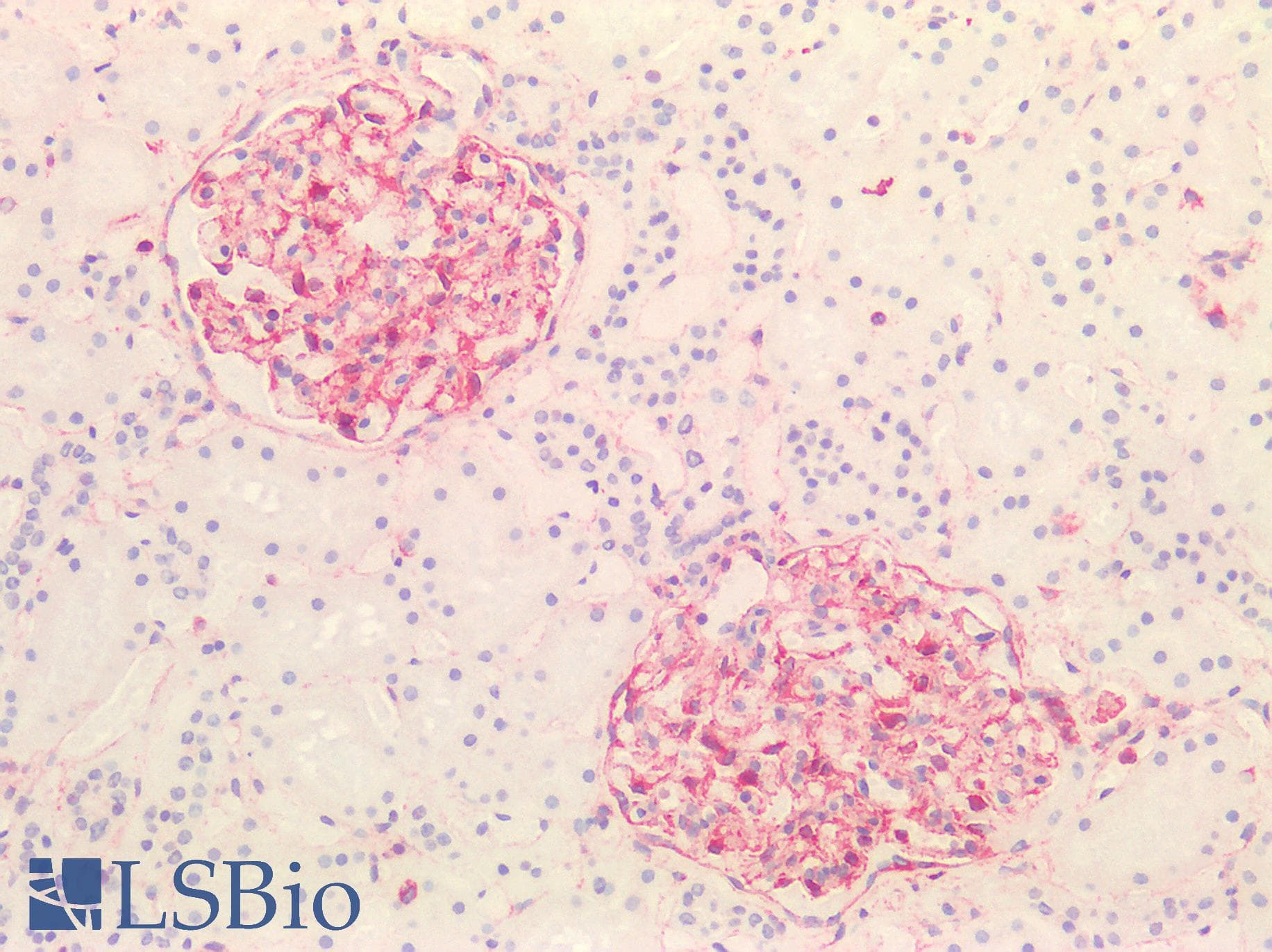 IHC-plus™ Polyclonal Rabbit anti-Human Vimentin Antibody (IHC, IF, WB)