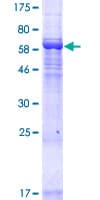 Human LRRC34 Protein (Recombinant GST)