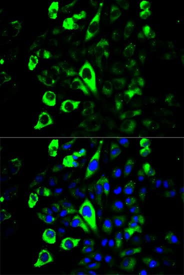 Polyclonal Rabbit anti-Human GZMB / Granzyme B Antibody (IF, WB)