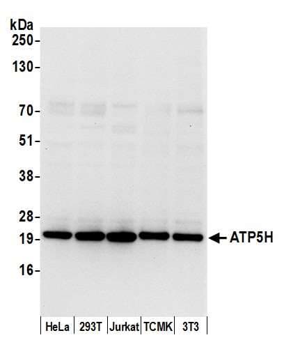 ATP5H Antibody (aa111-161)