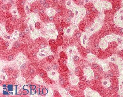 MBL2 / Mannose Binding Protein Antibody (aa179-228)