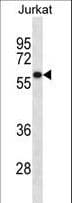 U2AF2 / U2AF65 Antibody (aa1-30)