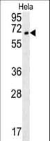 IHC-plus™ TMEM214 / FLJ20254 Antibody (aa38-66)