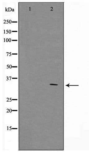ZNF498 Antibody