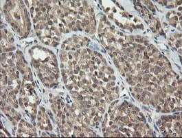 CATIP / C2orf62 Antibody (clone OTI2E6, Carrier-free)