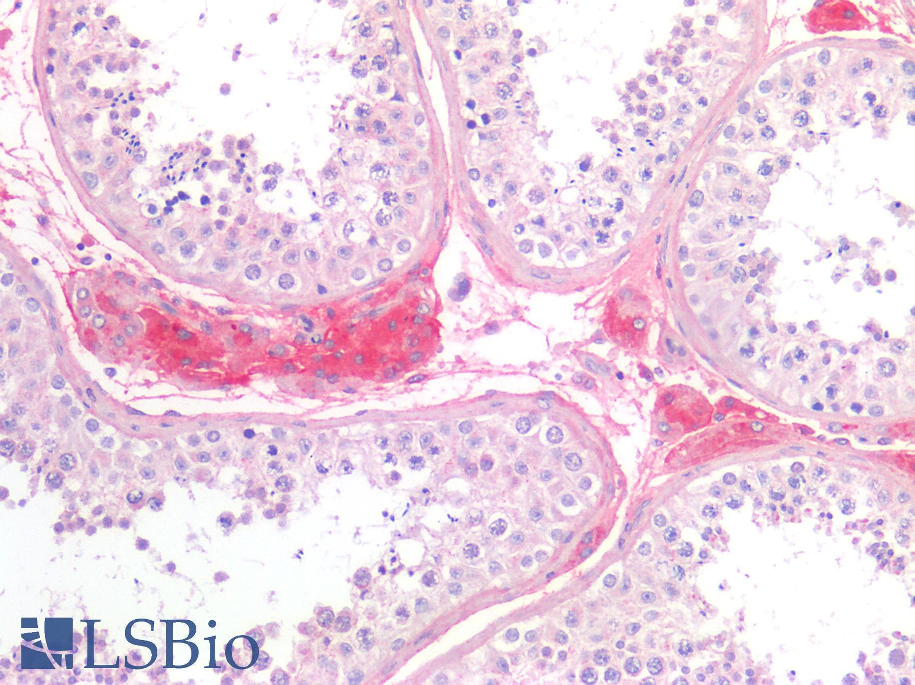 IHC-plus™ Monoclonal Mouse anti-Human FN1 / Fibronectin Antibody (IHC, IF, WB)