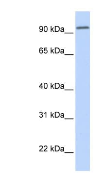 DPP6 / Dipeptidylpeptidase 6 Antibody (aa252-301, Biotin)