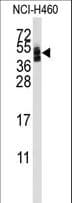 Polyclonal Rabbit anti-Human CXADR Antibody (aa132-161, WB)