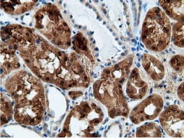 KHK / Ketohexokinase Antibody (clone OTI3D1)