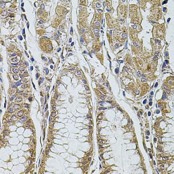 PDCD6IP / ALIX Antibody