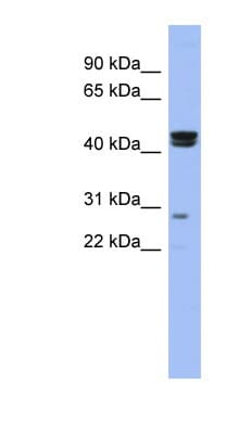 HSFY1 Antibody (N-Terminus)
