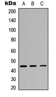 IL3RA / CD123 Antibody (Internal)