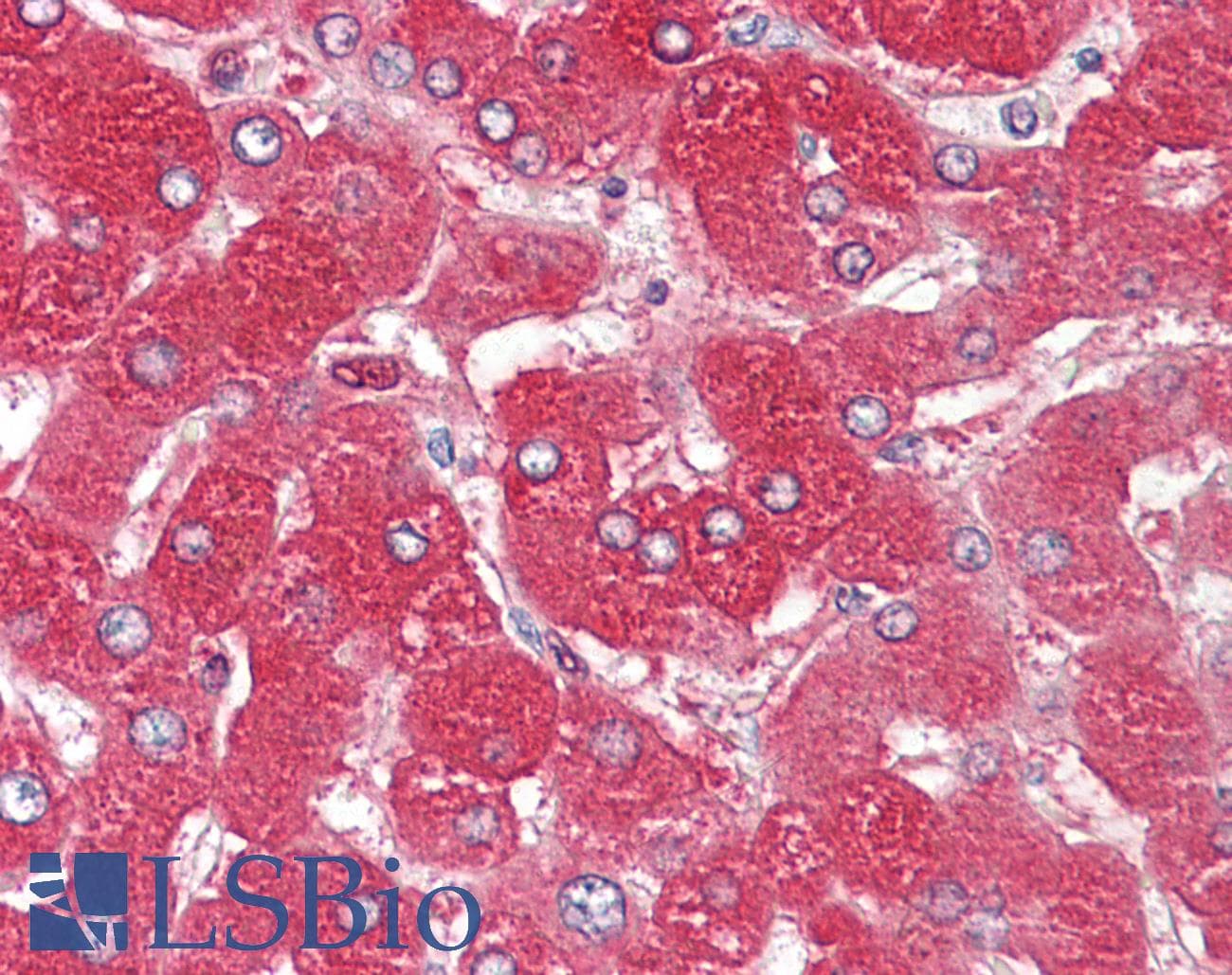IHC-plus™ ORM1 / Orosomucoid Antibody