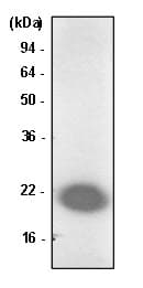 PARK7 / DJ-1 Antibody (clone 1B11)
