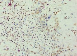 Polyclonal Rabbit anti-Human ARHGAP26 / GRAF Antibody (aa625-814, IHC)