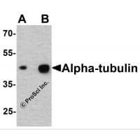 Polyclonal Rabbit anti-Human Alpha Tubulin Antibody (IHC, IF, WB)