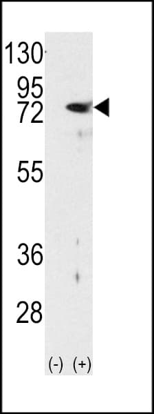 PRKCD / PKC-Delta Antibody (aa298-326)