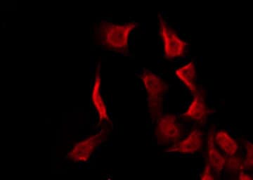 MC2R / ACTHR / ACTH Receptor Antibody