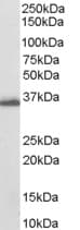 IHC-plus™ DDX / AKR1C3 Antibody (aa311-323)