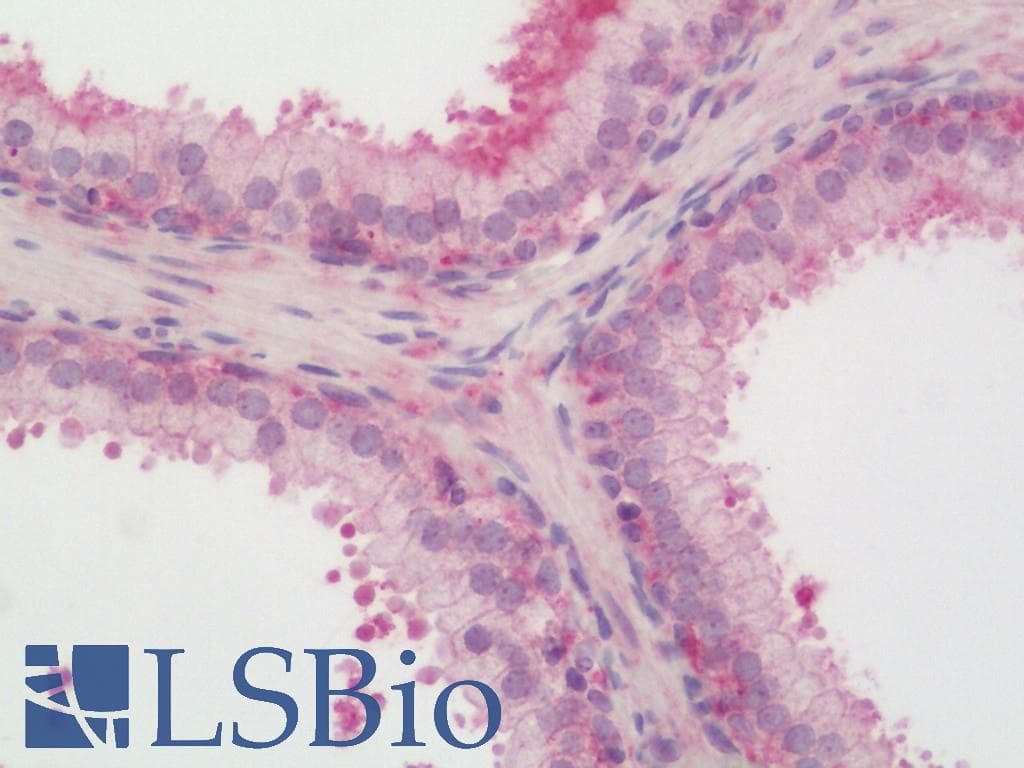 IHC-plus™ FPGT Antibody