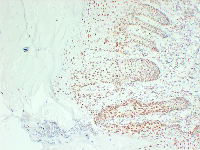 ER Alpha / Estrogen Receptor Antibody (clone ABT-ER)