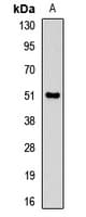 PNLIP / PL / Pancreatic Lipase Antibody