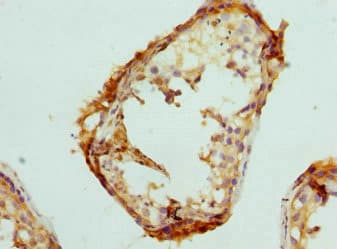 Polyclonal Rabbit anti-Human PSME1 Antibody (IHC, WB)