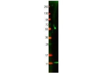 IL8 / Interleukin 8 Antibody (Lyophilized)