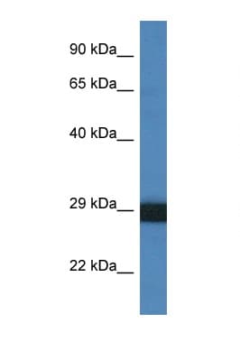 CTSG / Cathepsin G Antibody (aa178-227)