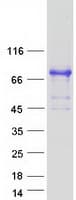 Human LIMD1 Protein (Recombinant Myc-DDK (Flag))