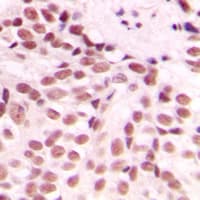 Polyclonal Rabbit anti-Human DDIT3 / CHOP Antibody (Internal, IHC, IF, WB)