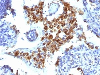 NAPSA / NAPA / Napsin A Antibody (clone NAPSA/1239, Ready-to-Use)
