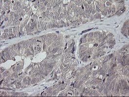 MAP2K3 / MEK3 / MKK3 Antibody (clone OTI5F9)